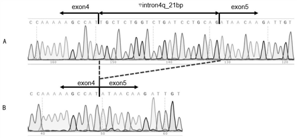 Application of estrogen receptor related receptor gamma (ESRRG) variant transcript in auxiliary diagnosis of pituitary adenoma