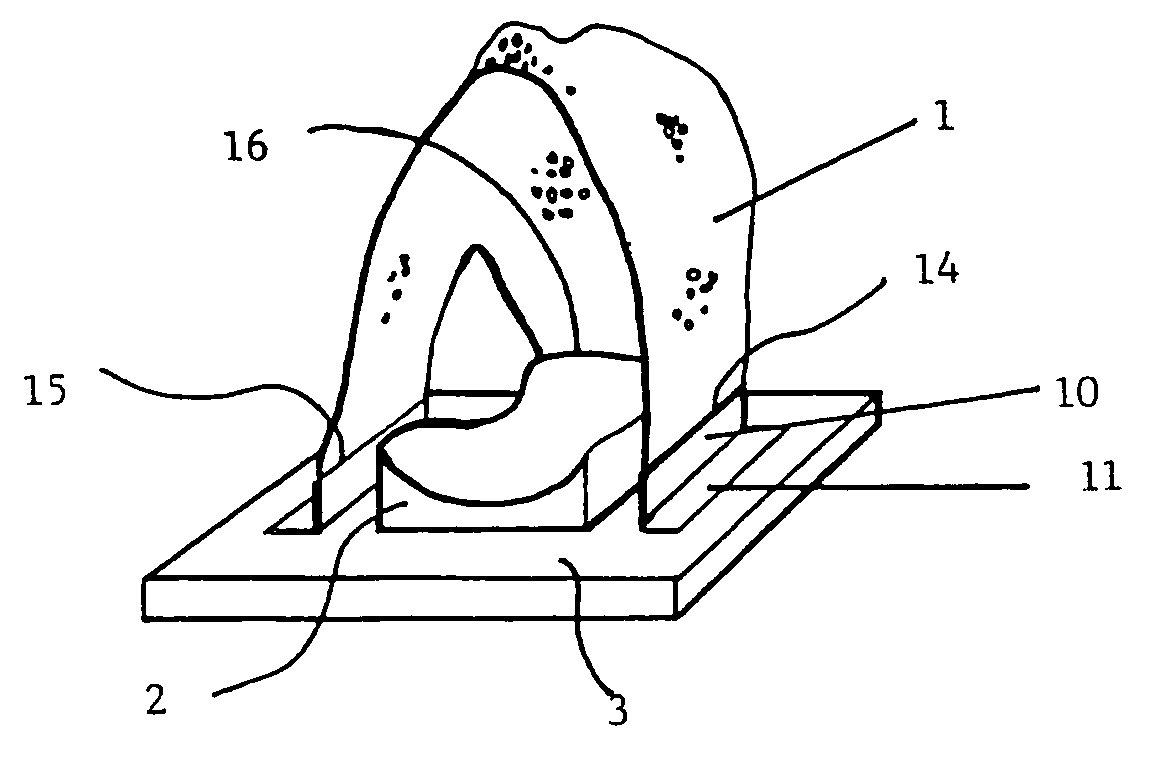 Head immobilisation assembly for patient positioning in radiation therapy