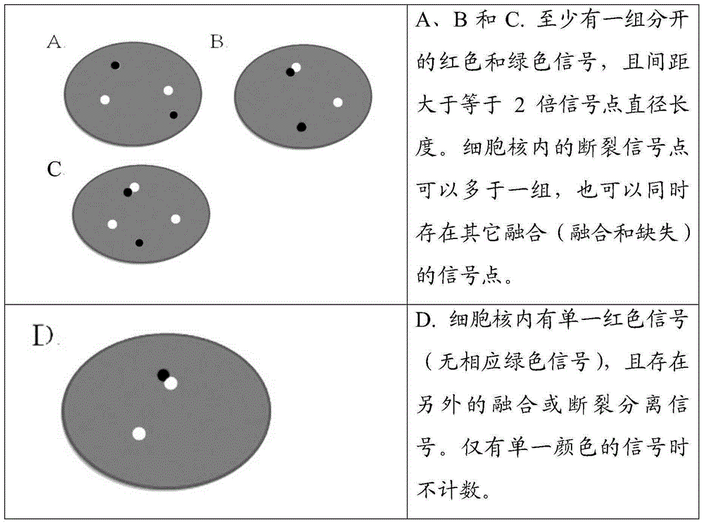 ALK gene rearrangement detection probe, kit and method