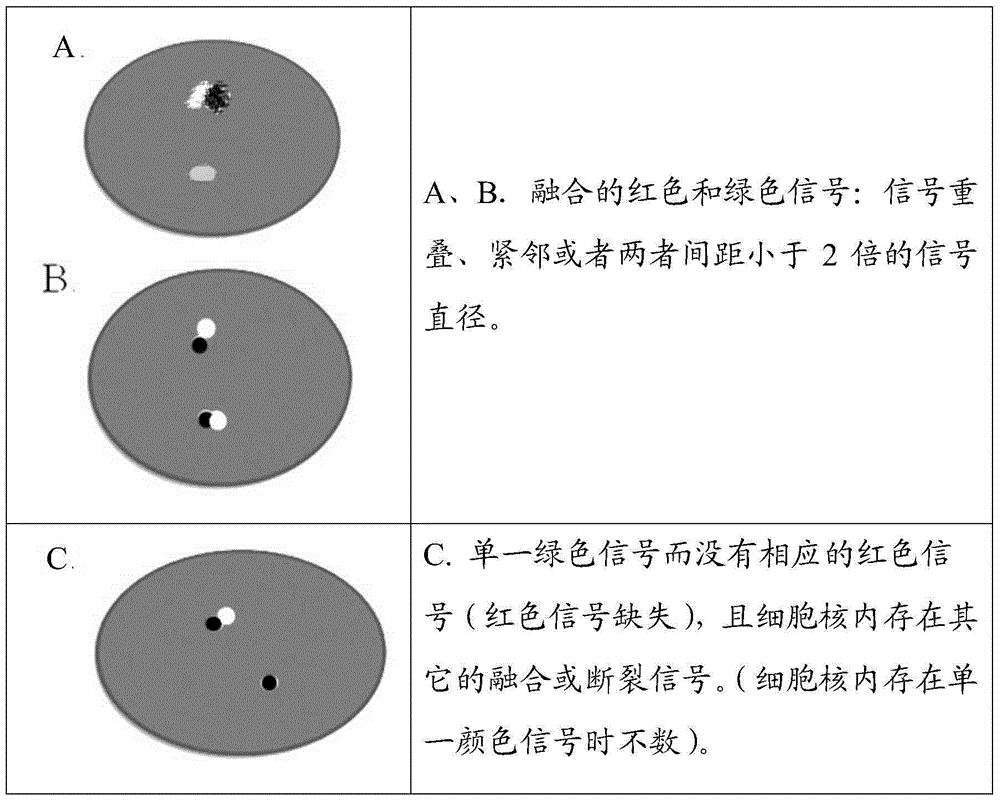 ALK gene rearrangement detection probe, kit and method