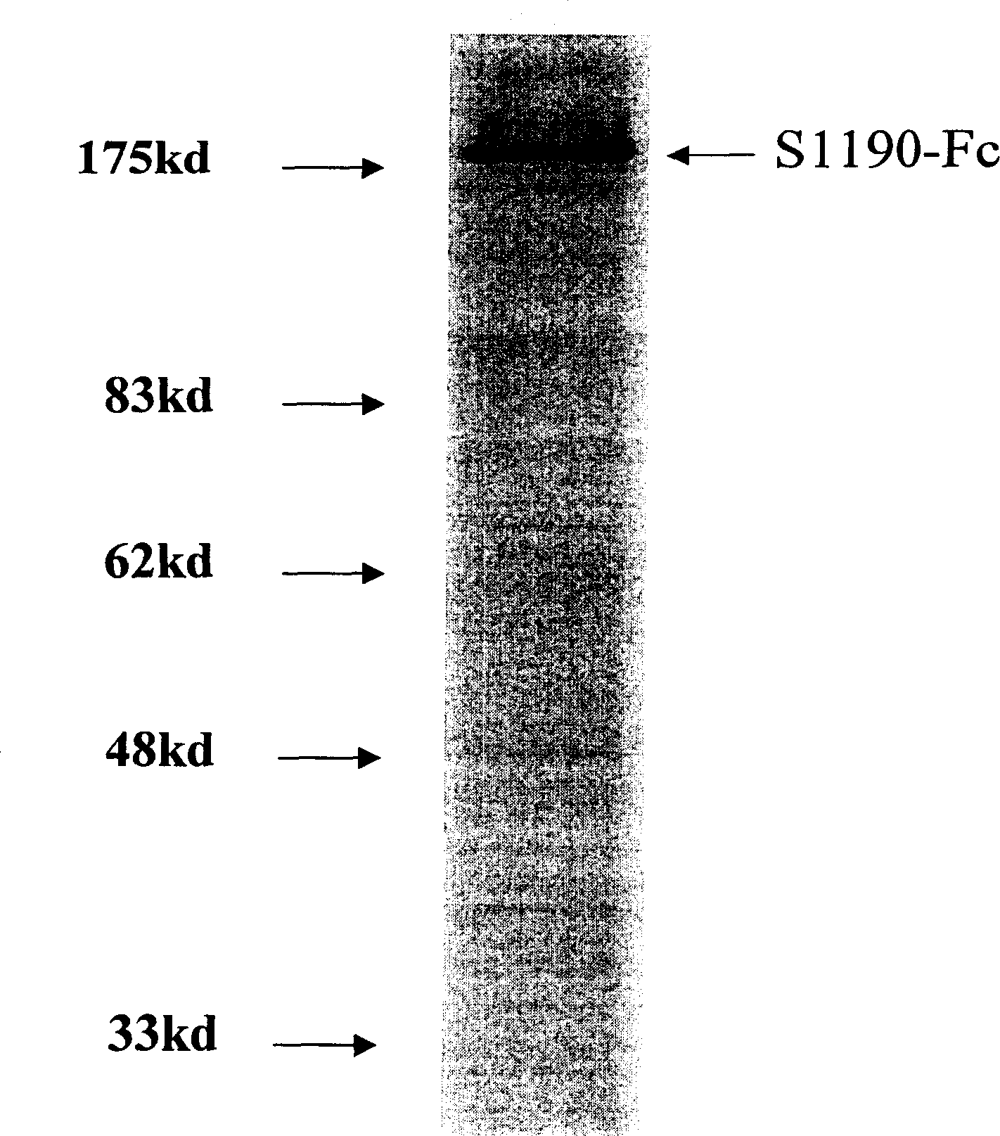 SARS-CoV virus structural protein infusion protein and its high yield expression and purification and uses