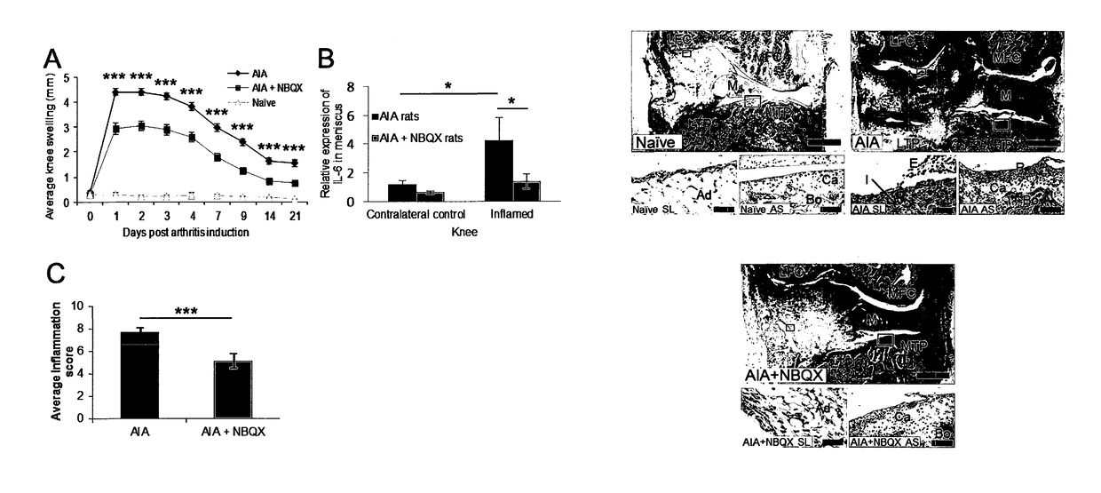 Methods and compounds for preventing osteoarthritis