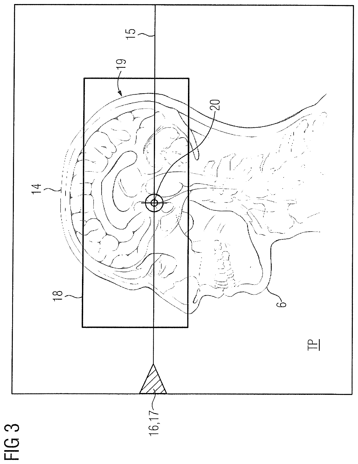 Method and apparatus for adjustment of a table position in a medical data acquisition scanner