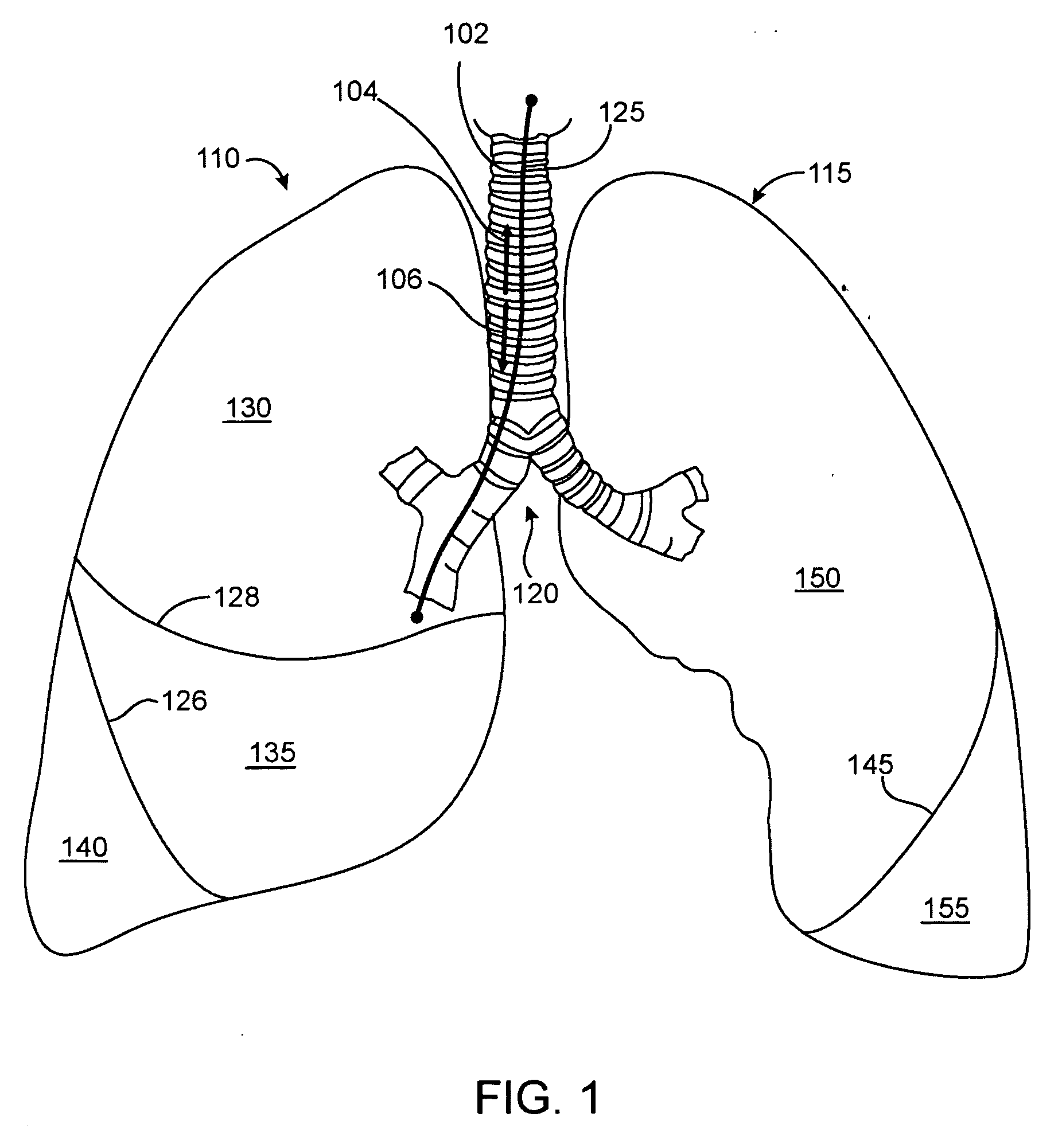 Methods and devices for inducing collapse in lung regions fed by collateral pathways