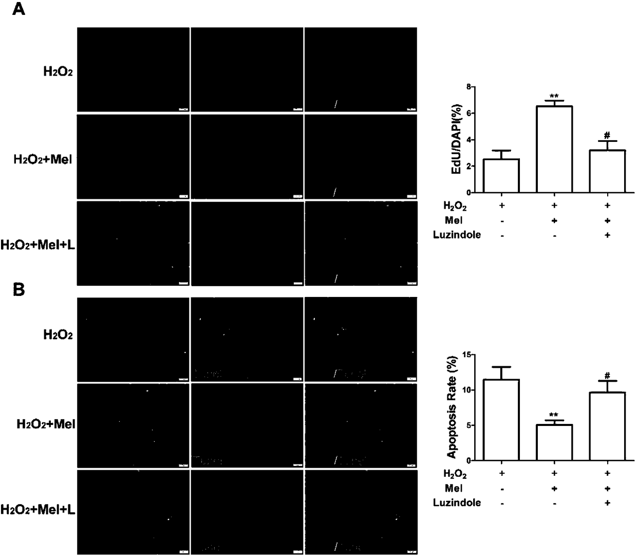 Application of melatonin in promotion of cardiac stem cell transplanting for treating myocardial infarction