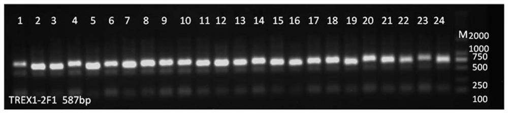 Primers, kit and method for detecting TREX1 gene mutation