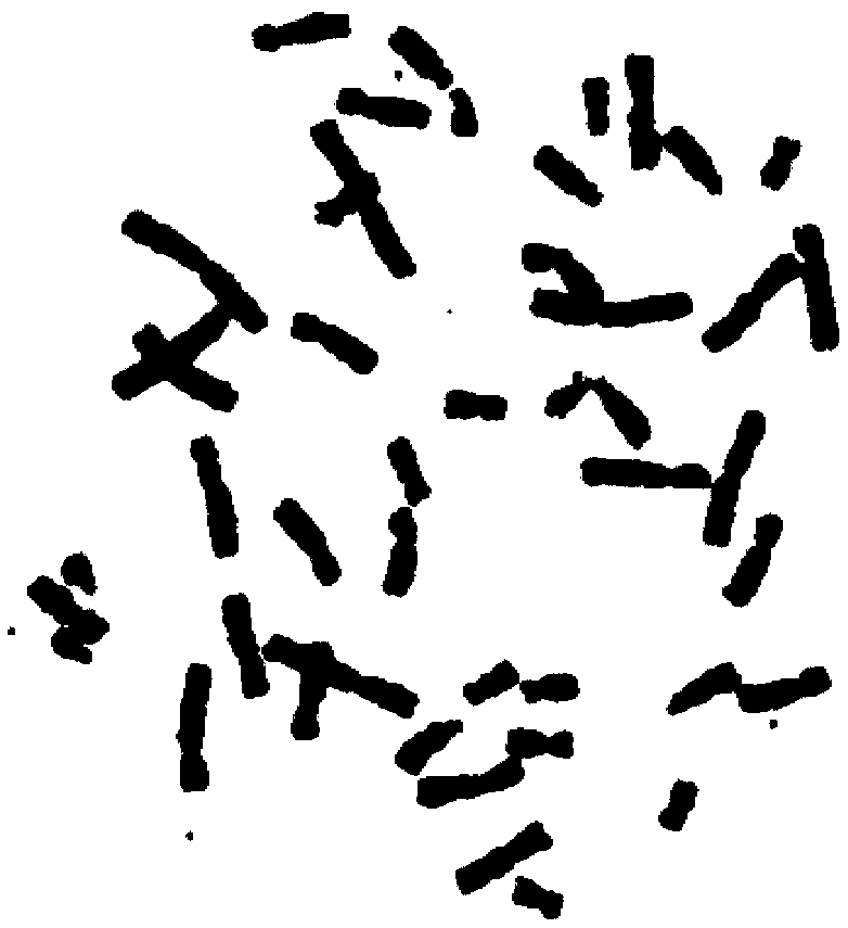 An automatic chromosome counting method based on depth learning