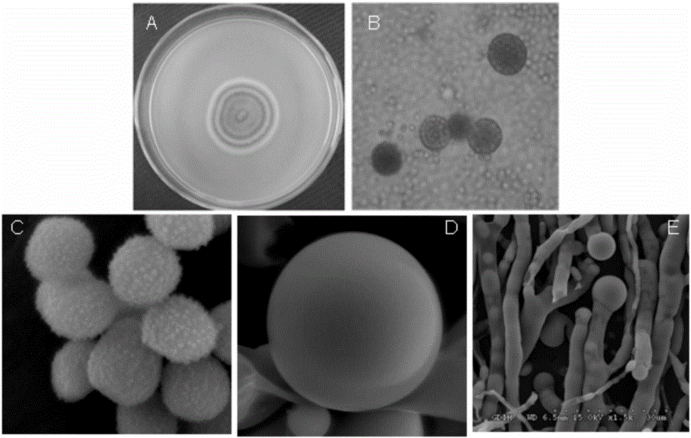 Application of mycelium extract of strain culture of marine fungus umbelopsis sp. in preparation of antibacterial drugs