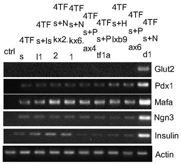 A method for inducing insulin-secreting cells based on human skin cells and its application