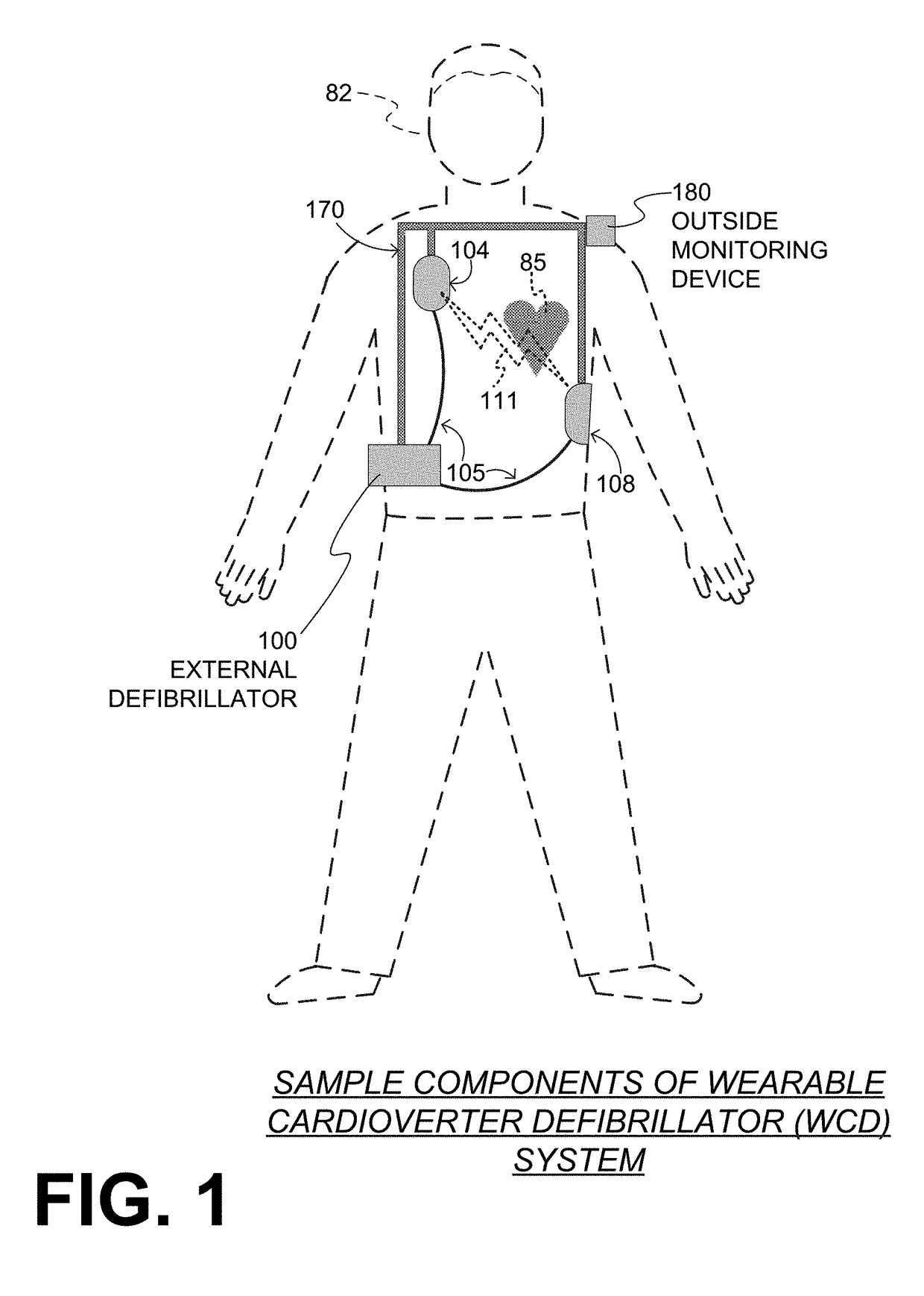 Wearable cardioverter defibrillator (WCD) system reacting to high-frequency ECG noise