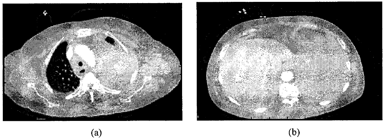 An Improved CT image aorta segmentation method based on an active shape model