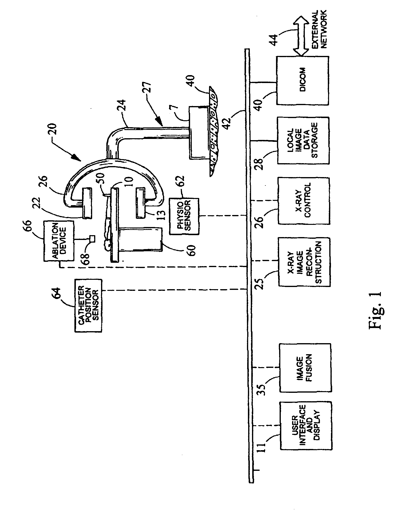 Method and system for performing ablation to treat ventricular tachycardia