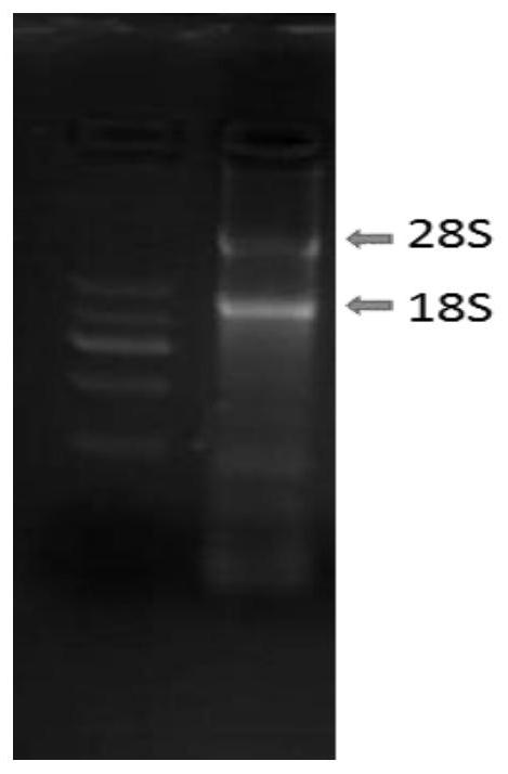 A kind of heavy/light chain variable region of pinp recombinant antibody and coding gene and recombinant antibody