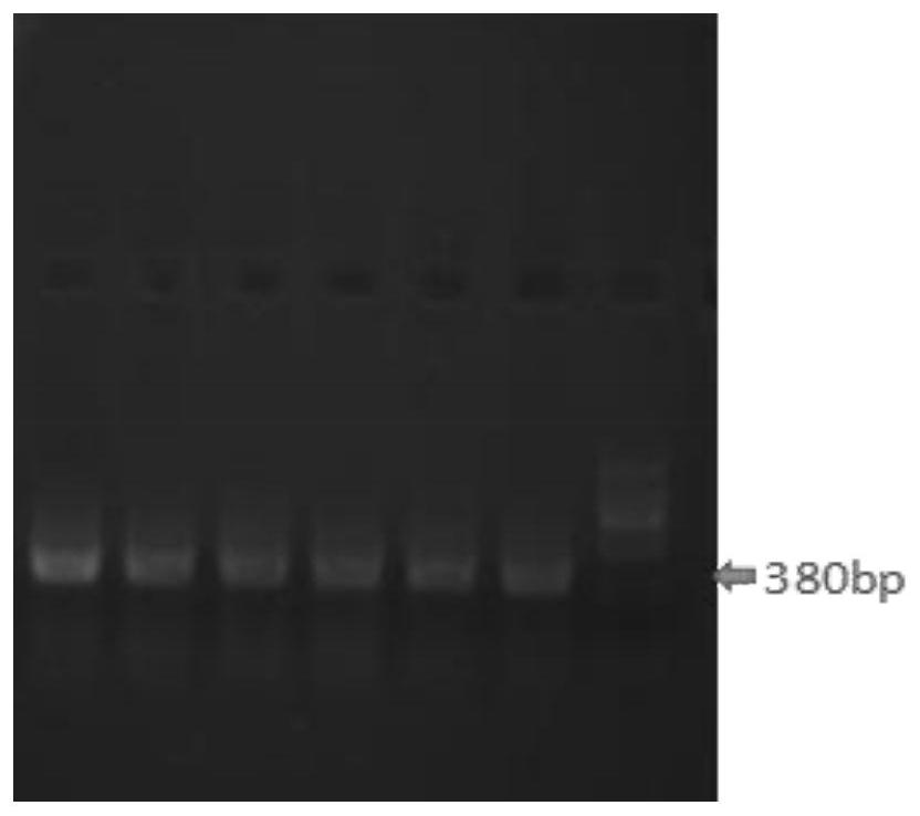 A kind of heavy/light chain variable region of pinp recombinant antibody and coding gene and recombinant antibody