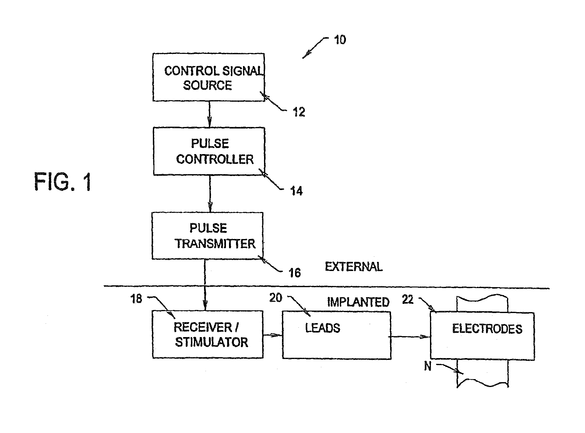 Systems and methods for reversibly blocking nerve activity