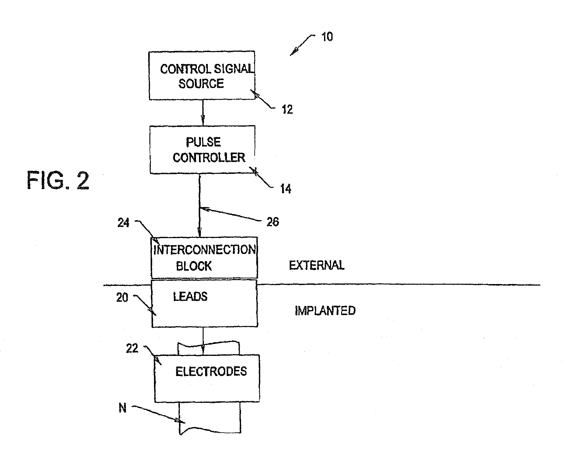 Systems and methods for reversibly blocking nerve activity