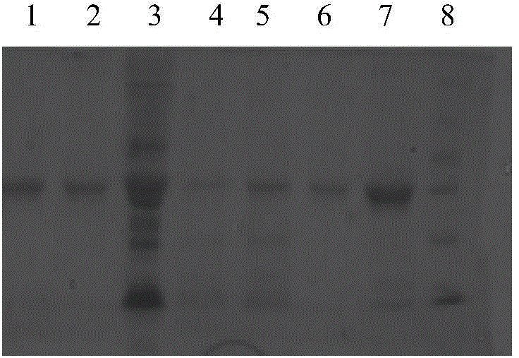 Hybridoma cell capable of secreting anti-cystatin S monoclonal antibody as well as monoclonal antibody and application of hybridoma cell