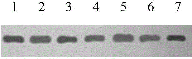 Hybridoma cell capable of secreting anti-cystatin S monoclonal antibody as well as monoclonal antibody and application of hybridoma cell