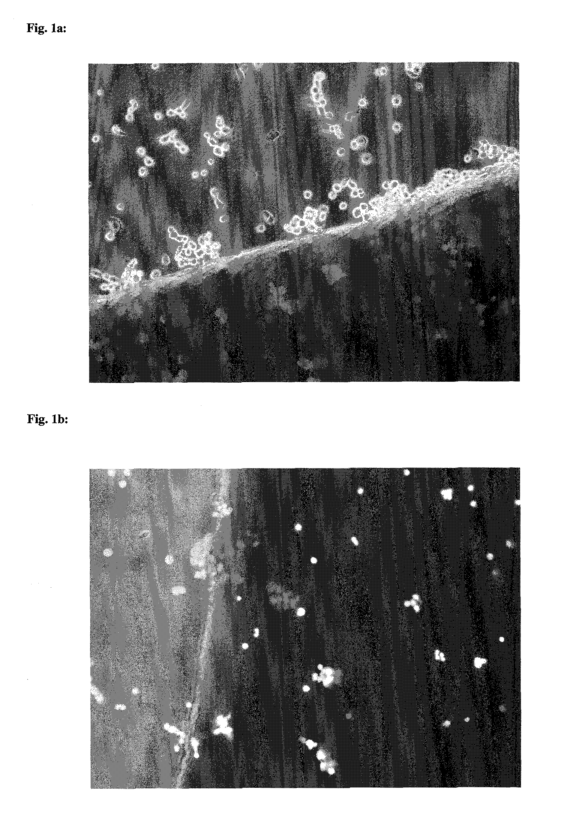 Collagen implant