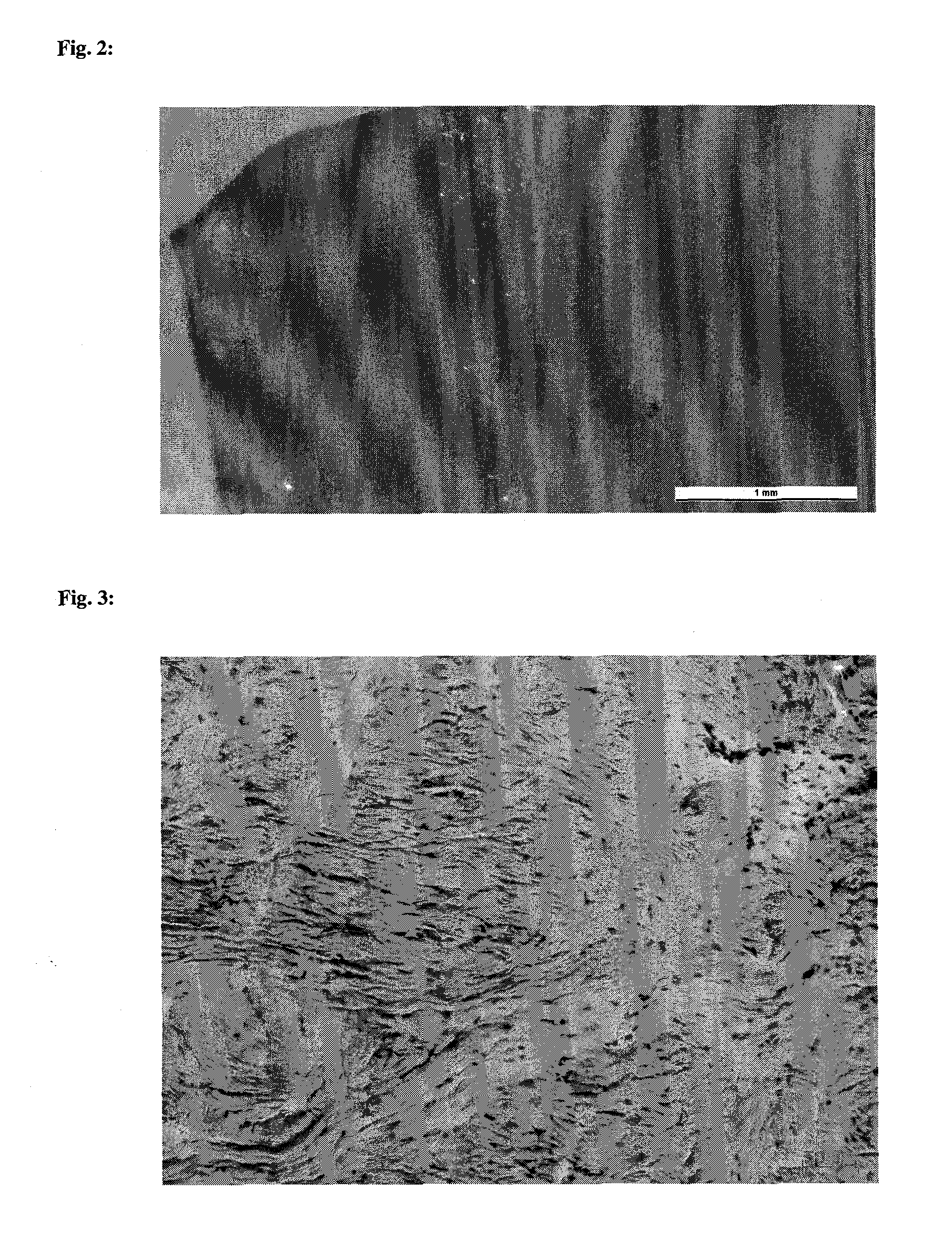 Collagen implant