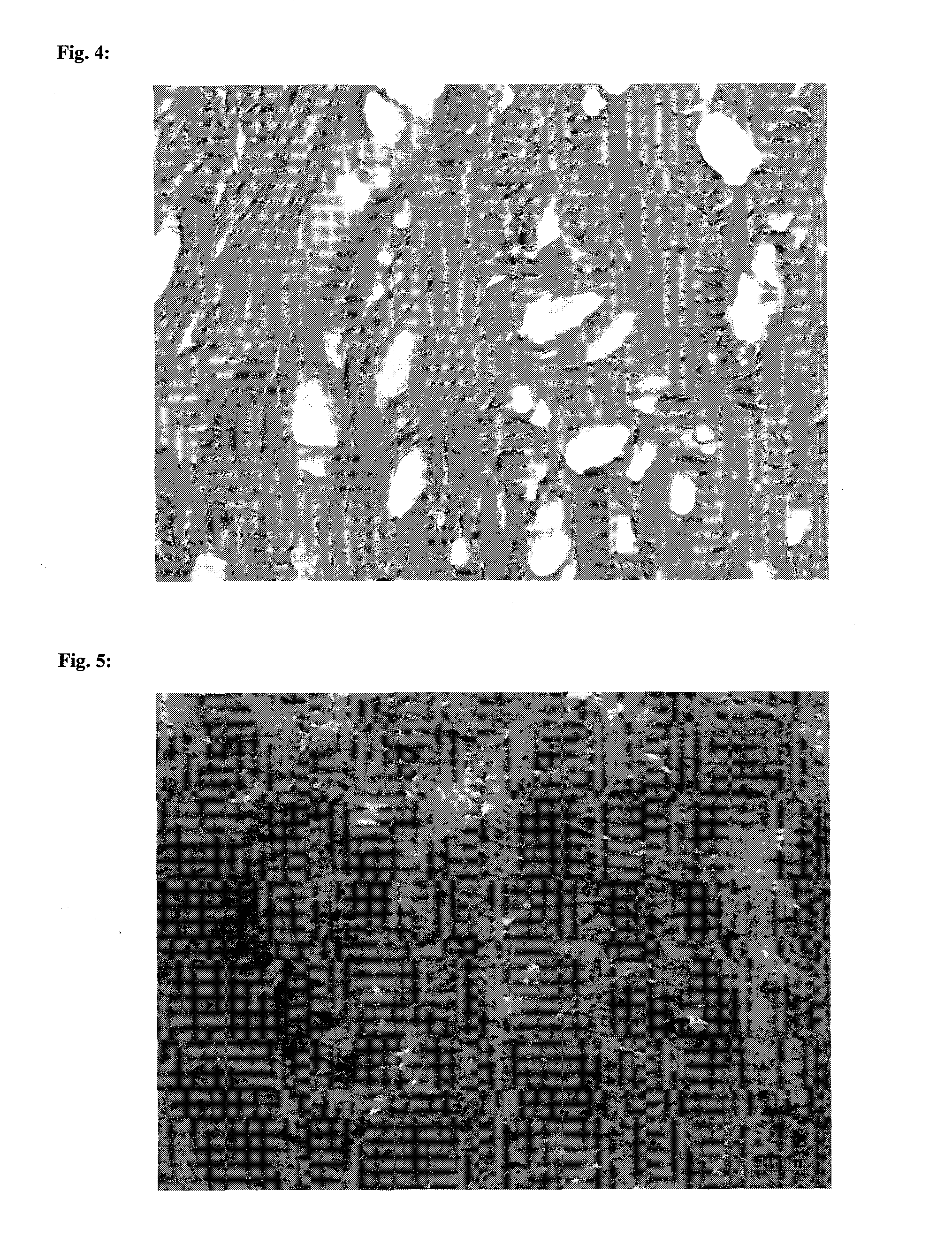 Collagen implant