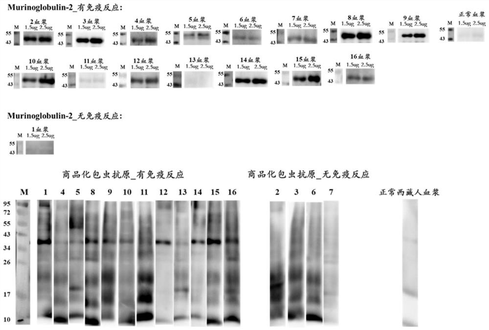 New echinococcosis antigen Murinoglobulin-2 protein