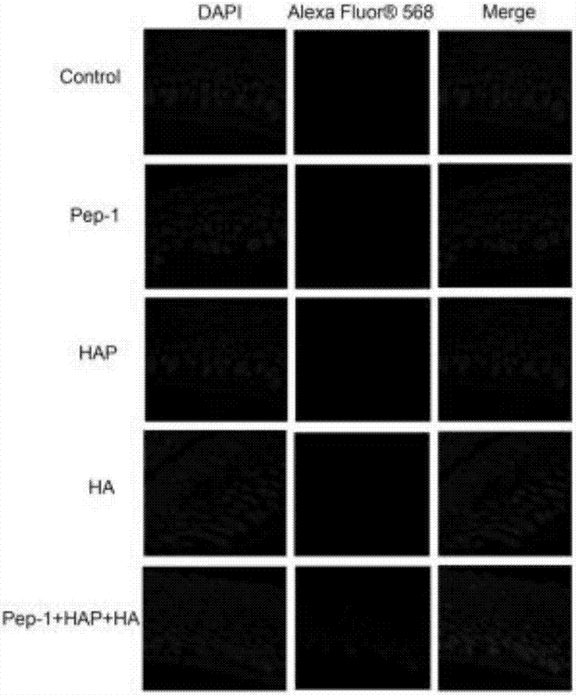 Novel hyaluronic acid binding peptide (HaBP) and transdermal absorption and subcutaneous targeted release preparation