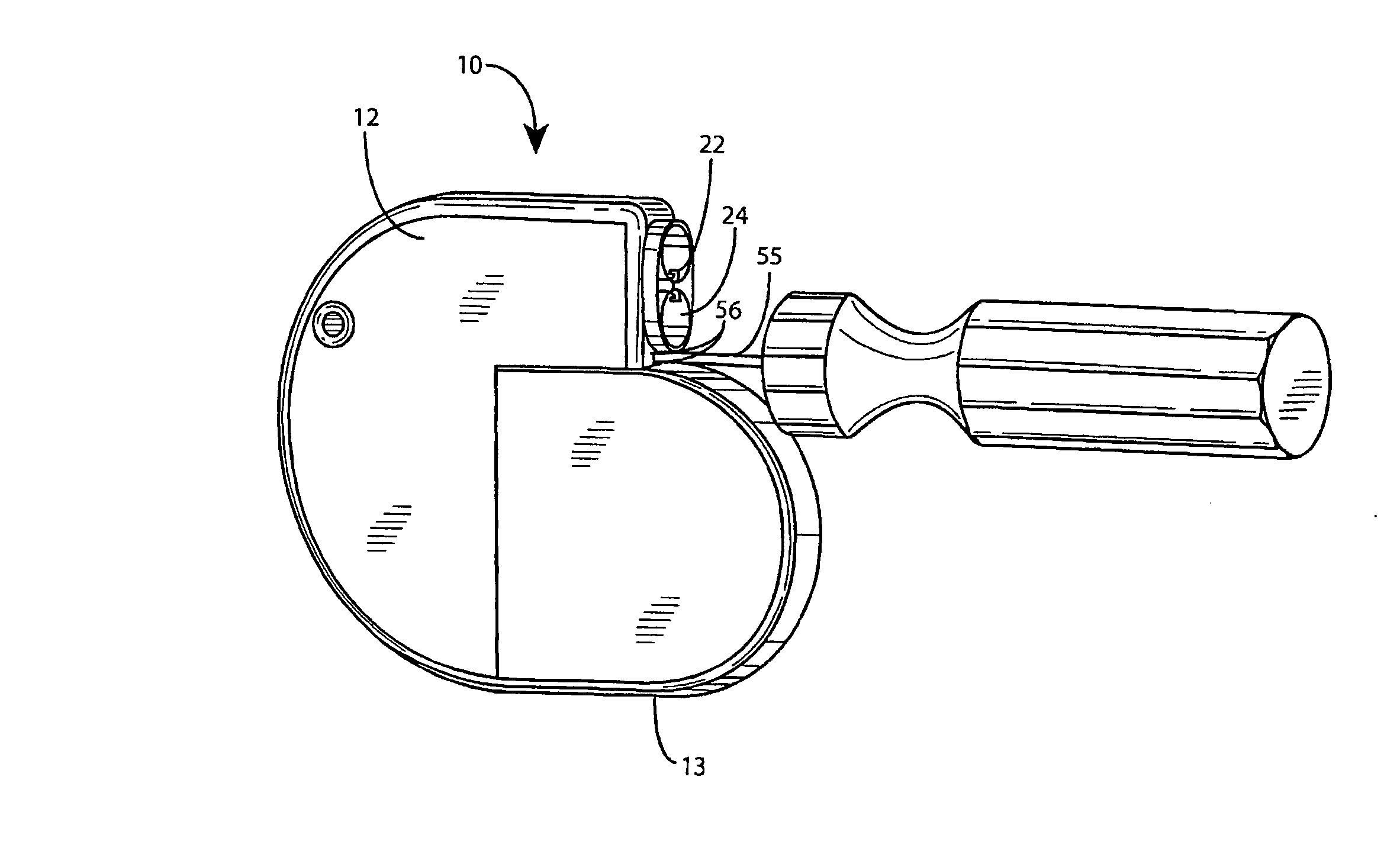 Implantable medical device with detachable battery compartment