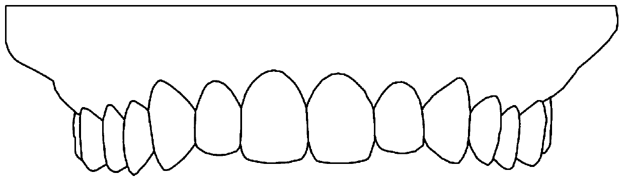 Method for guiding and segmenting teeth by utilizing morphological data