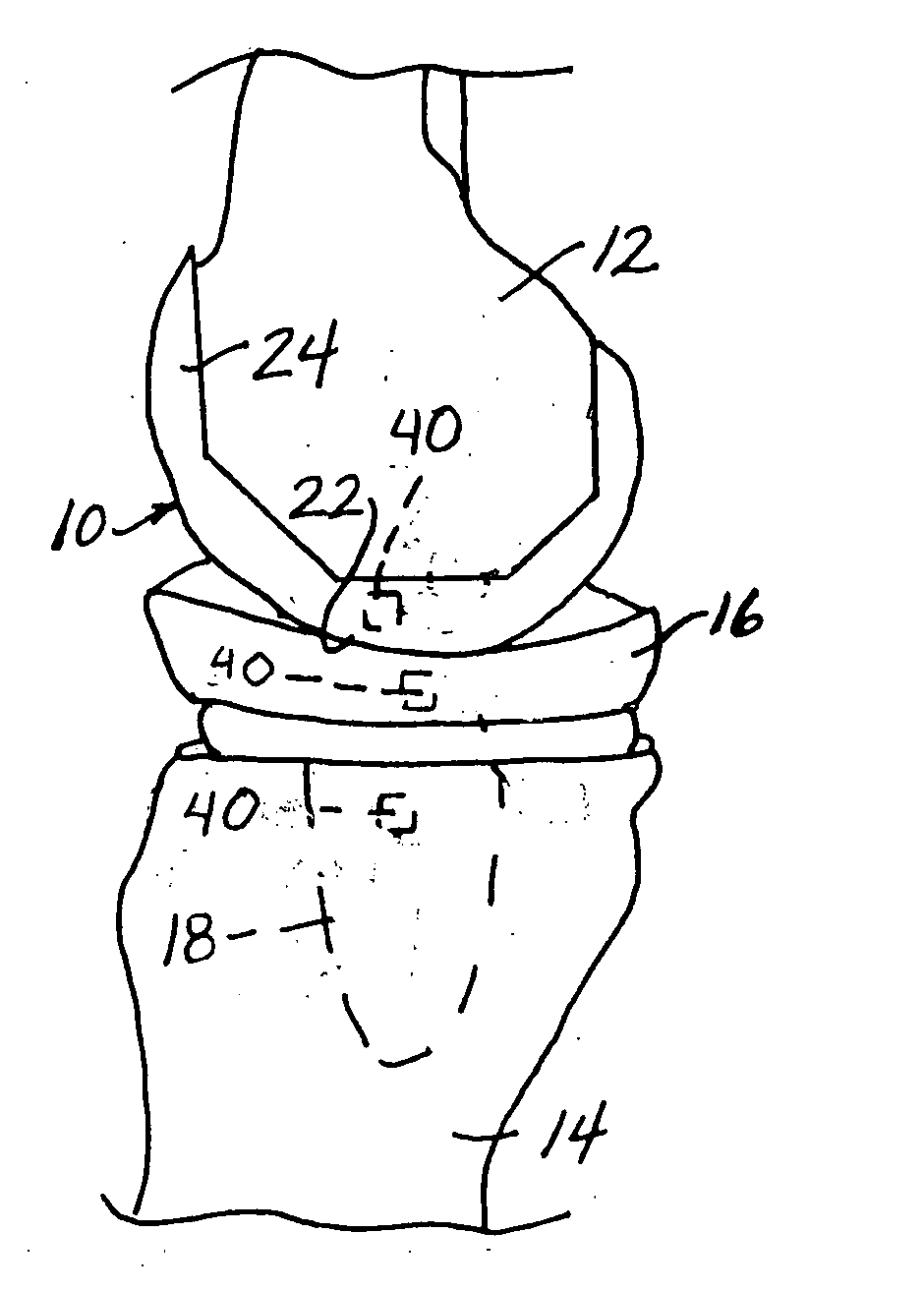 Orthopaedic components with data storage element