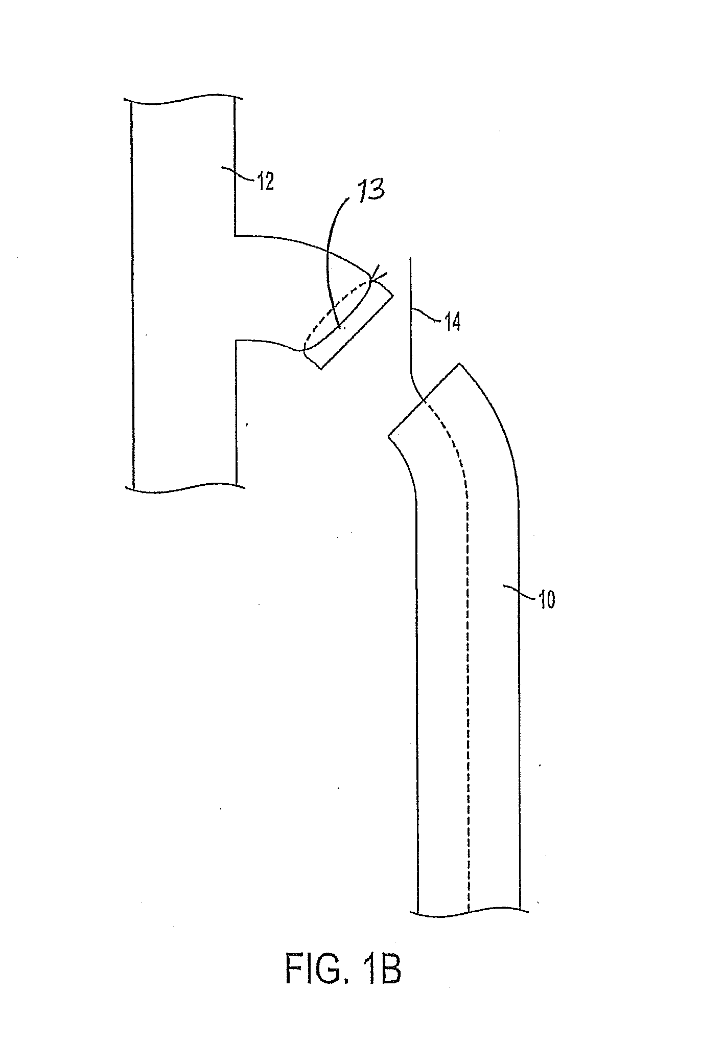 Venous closure catheter and method for sclerotherapy