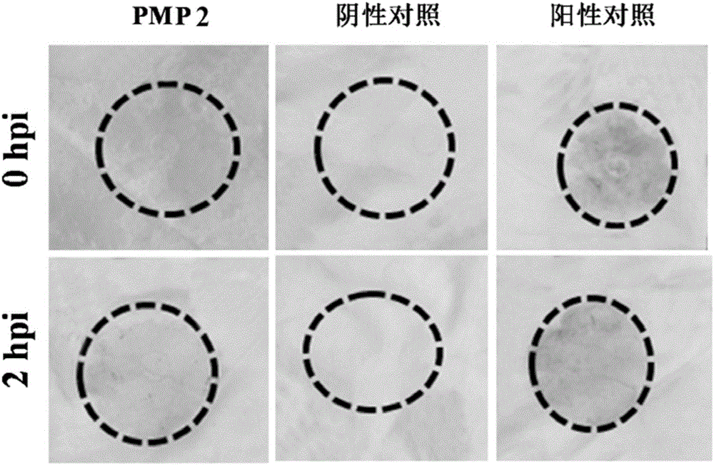 Phytophthora induced artificially synthesized promoter PMP2 as well as recombinant expression vector and application thereof