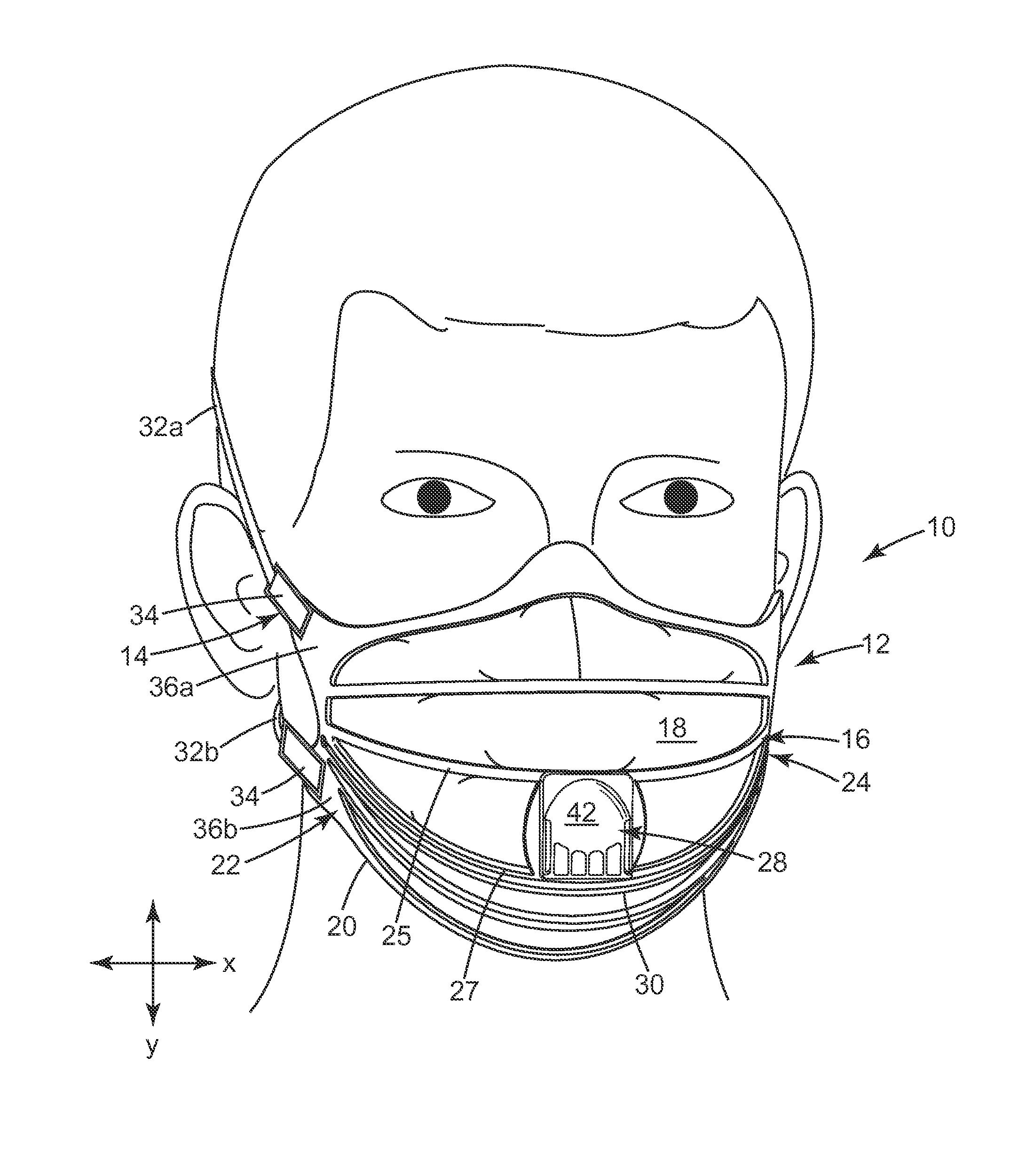 Filtering face-piece respirator having an integrally-joined exhalation valve