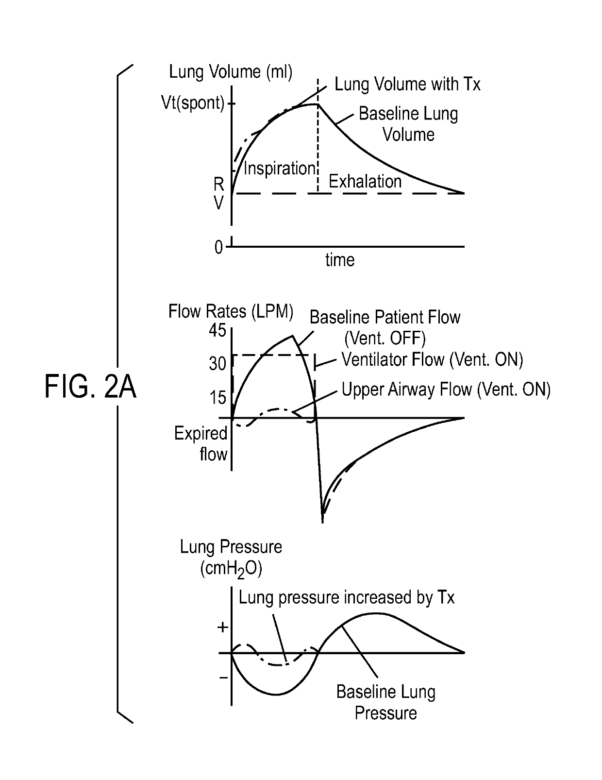 Ventilator with biofeedback monitoring and control for improving patient activity and health