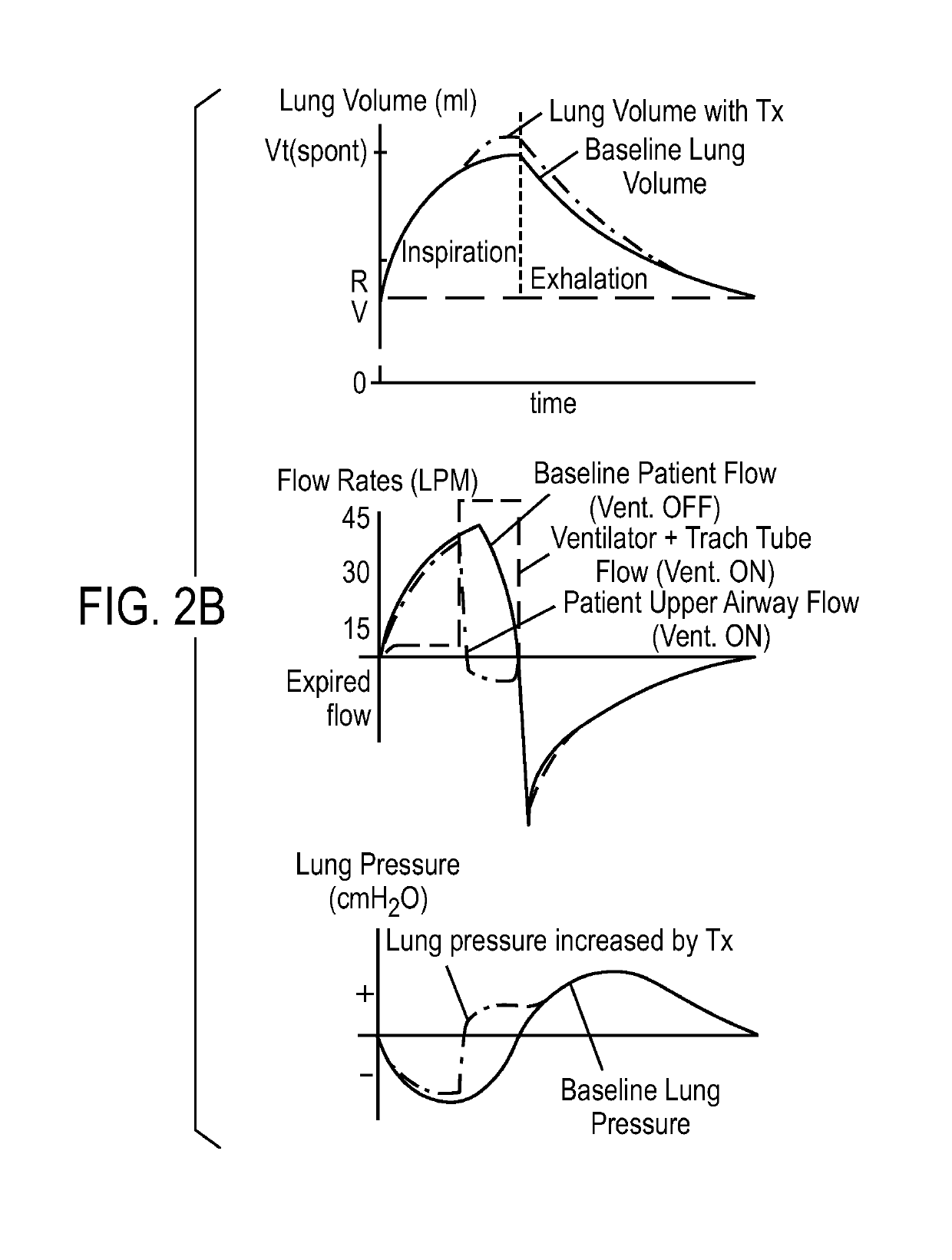 Ventilator with biofeedback monitoring and control for improving patient activity and health