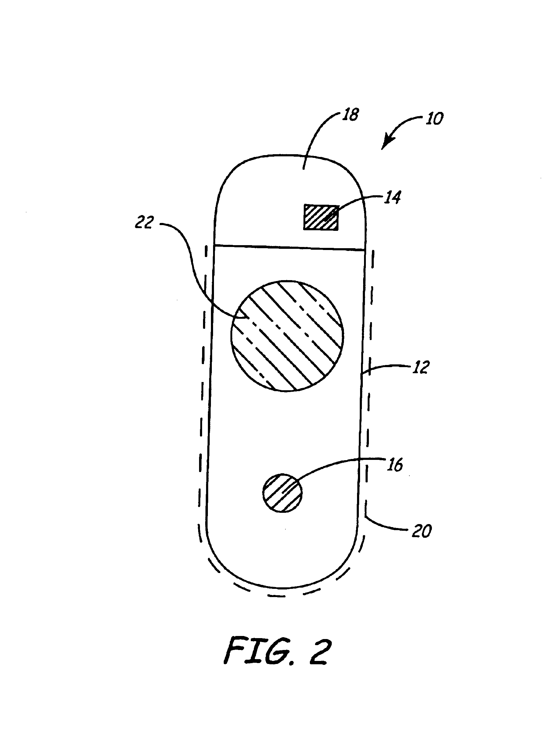 Apparatus and method for chronically monitoring heart sounds for deriving estimated blood pressure