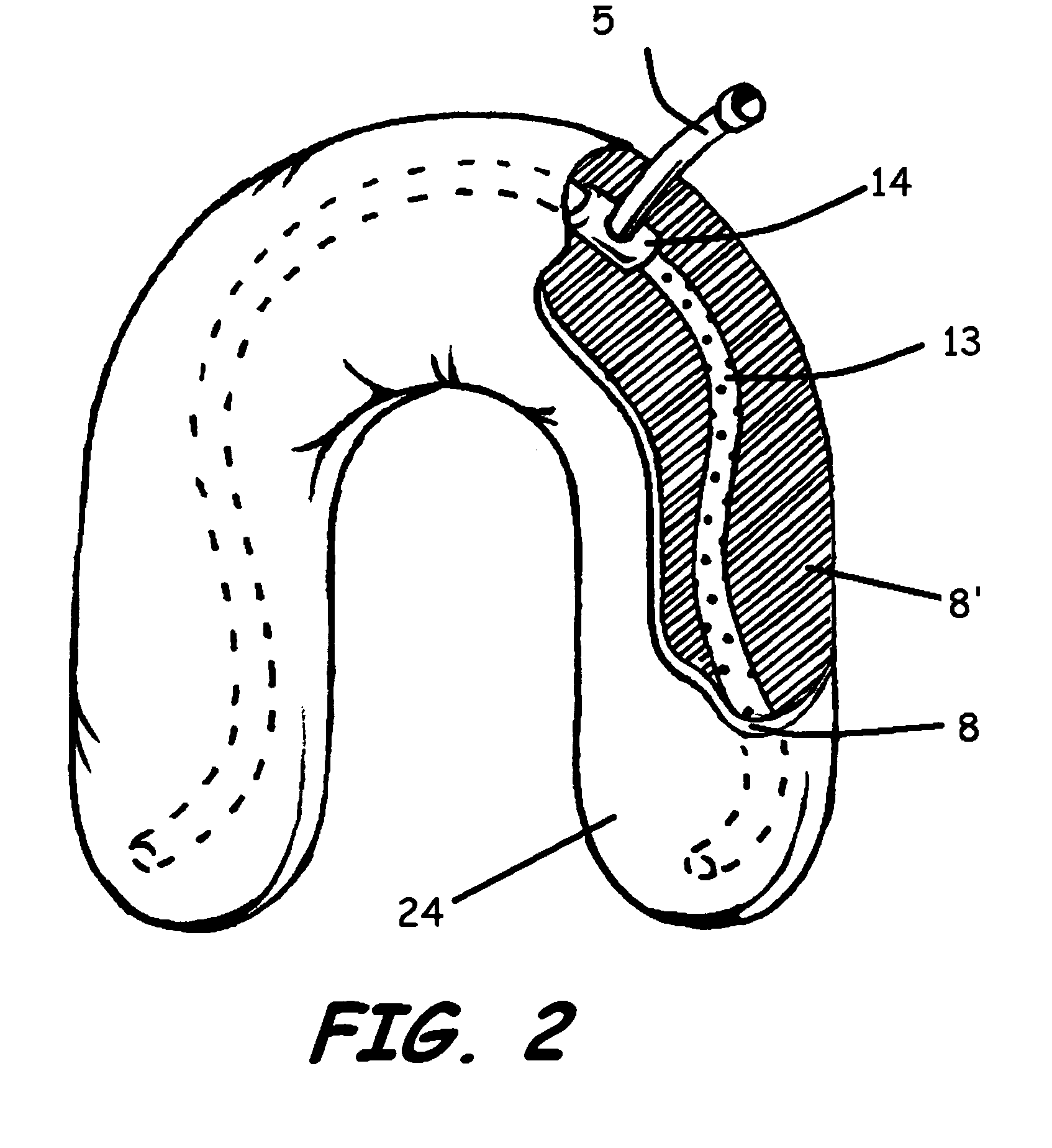 Method and device for automatic buoyancy compensation for a scuba diver or underwater device while in any orientation