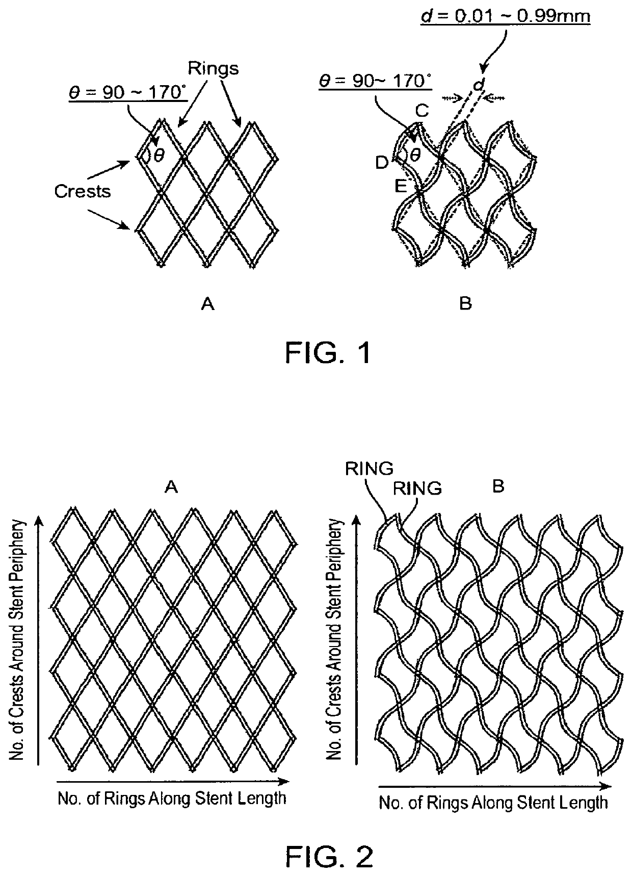 Close-cell structured stent, a preparation method and use thereof