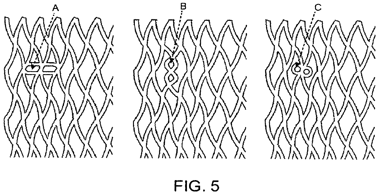 Close-cell structured stent, a preparation method and use thereof