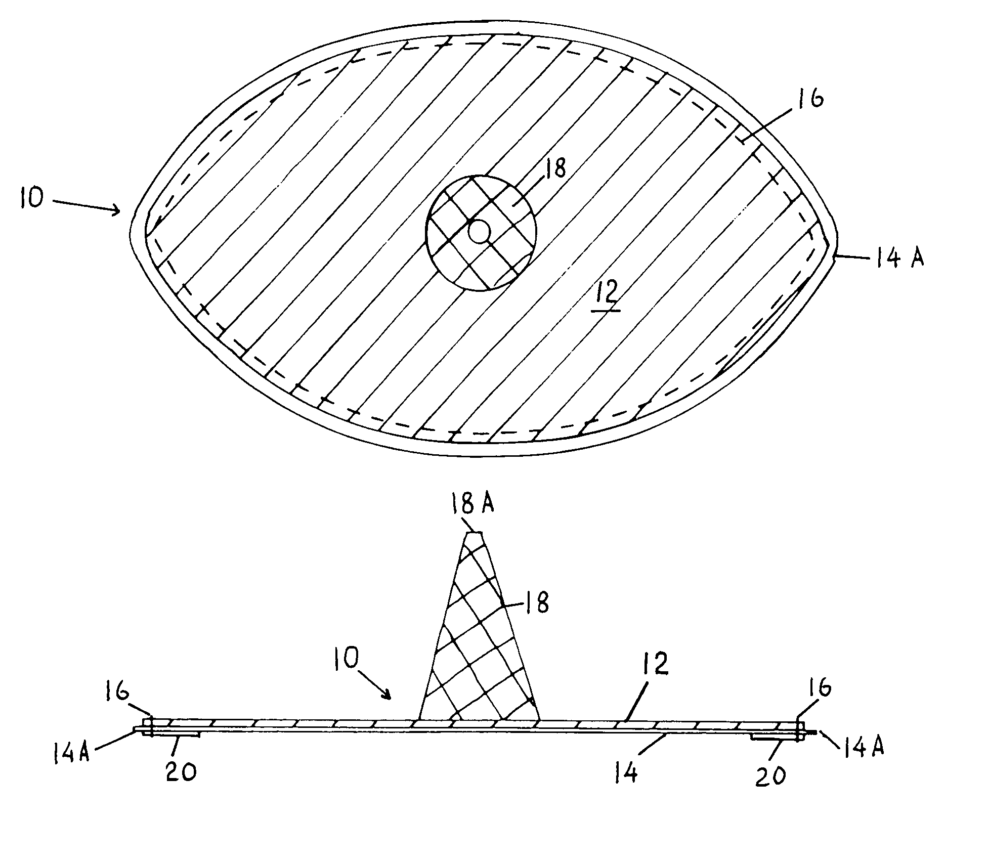 Laparoscopic inguinal hernia prosthesis