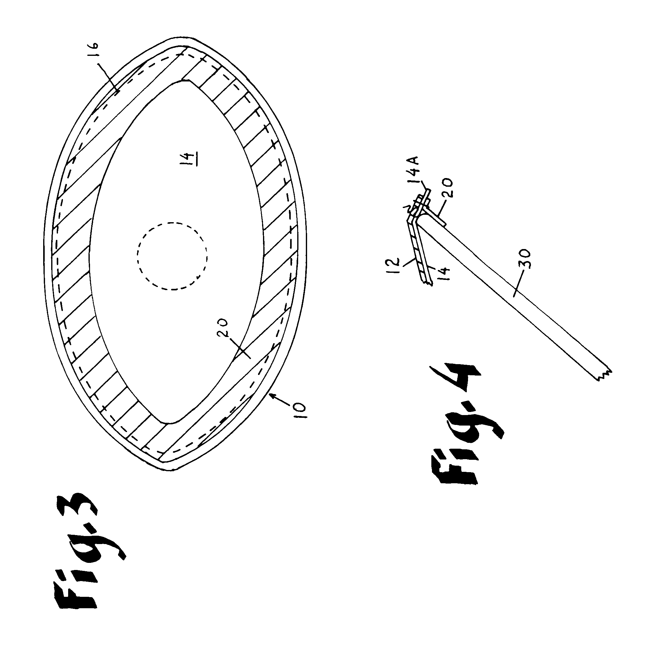 Laparoscopic inguinal hernia prosthesis