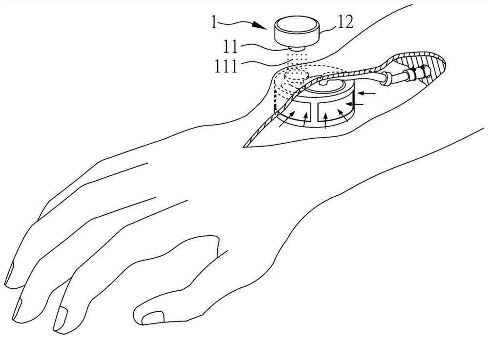 Device for draining lymph fluid to veins