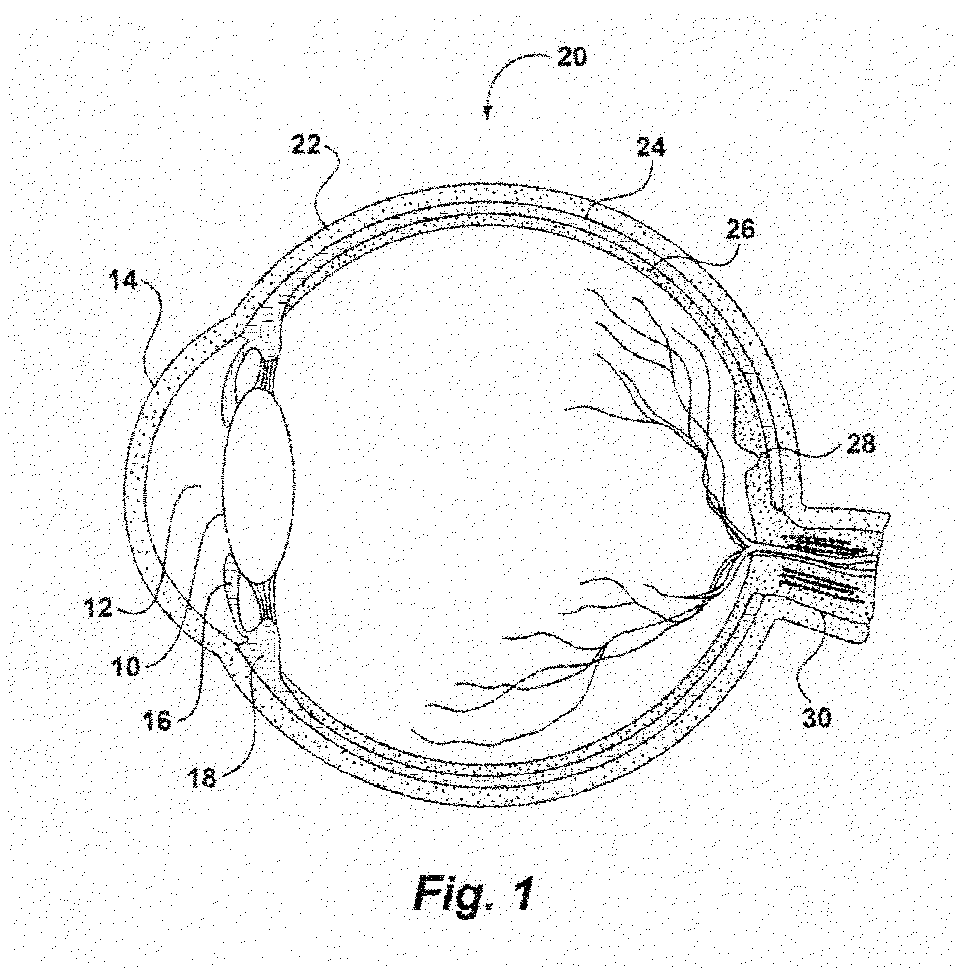 System and Method for Storing, Shipping and Injecting Ocular Devices