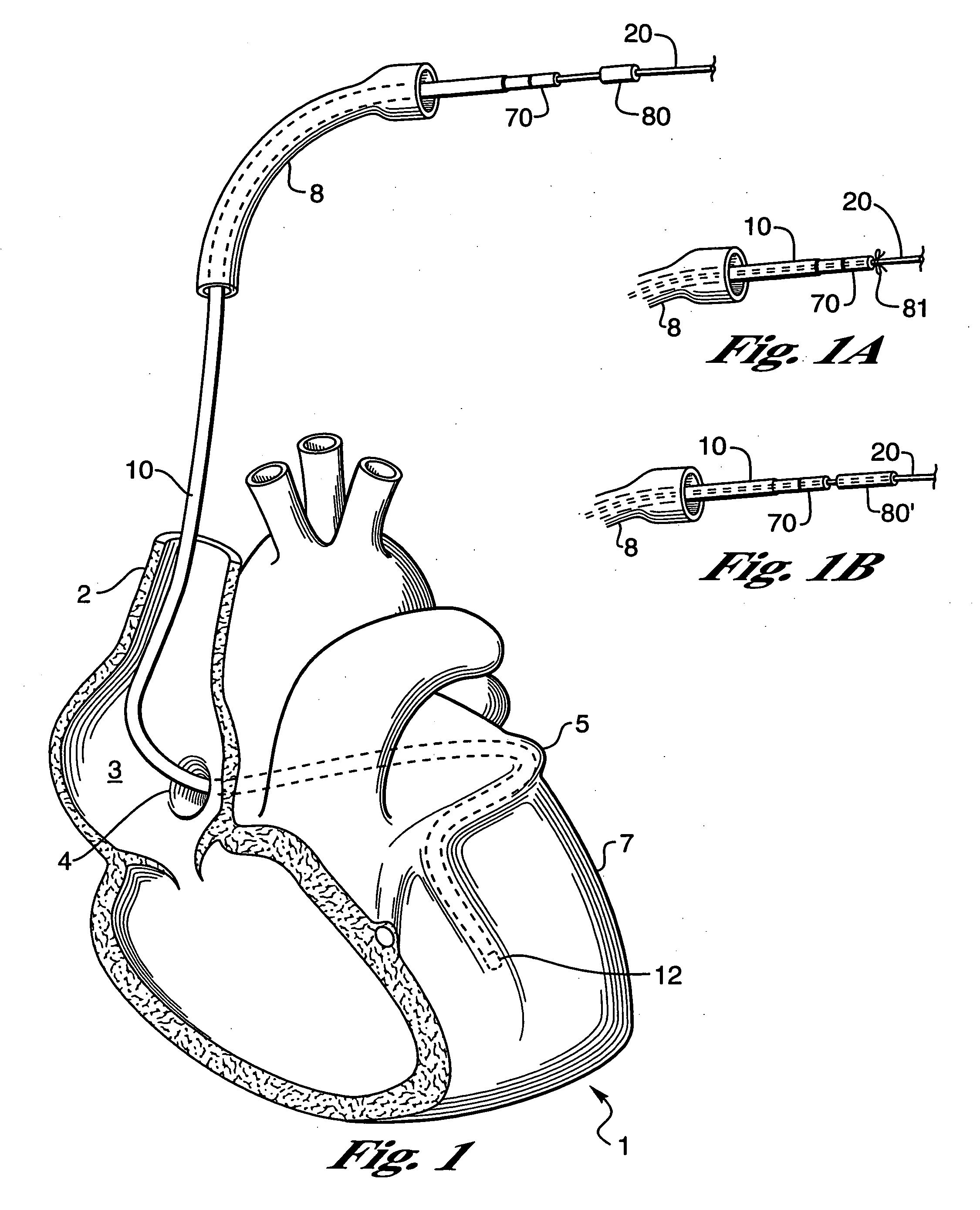 Modified guidewire for left ventricular access lead