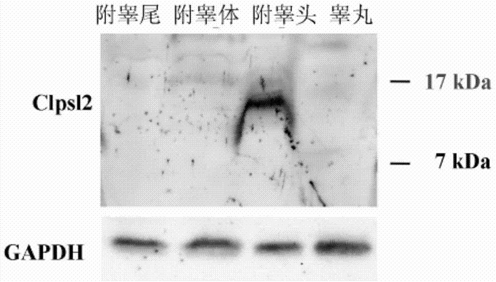 Interference fragment of colipase-like 2 (Clpsl2) gene and application of interference fragment