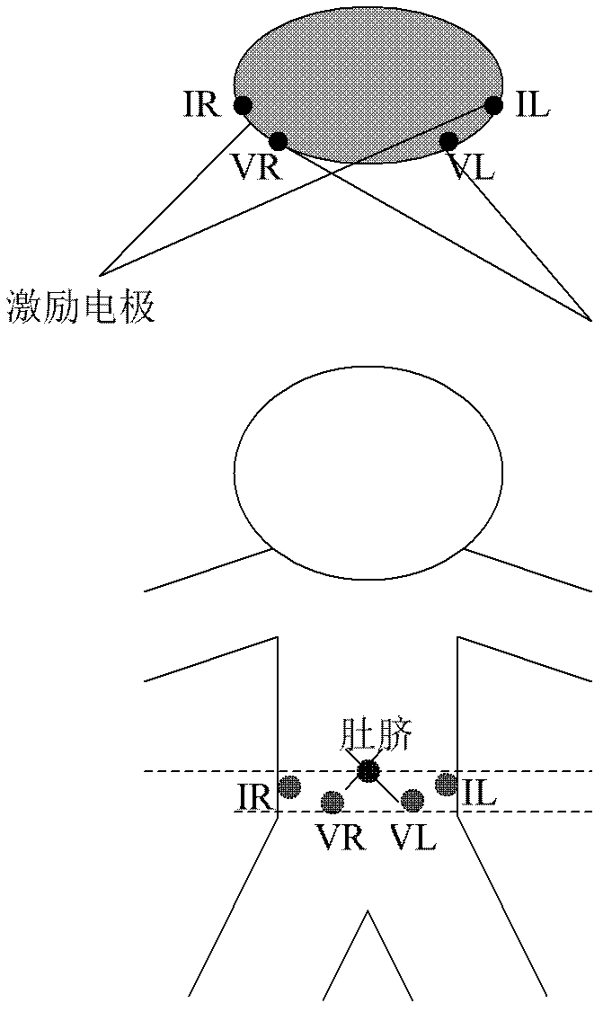 Non-invasive type urination alarming device based on bioelectrical impedance and monitoring method