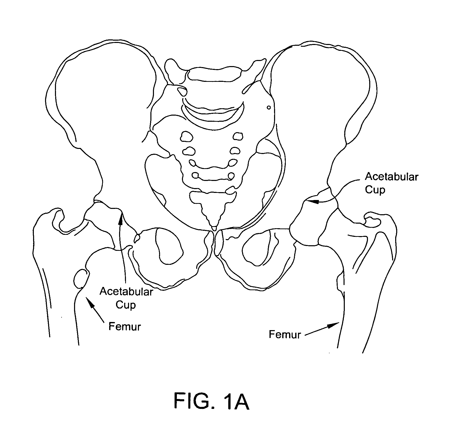 Methods and apparatus for performing an arthroscopic procedure using surgical navigation