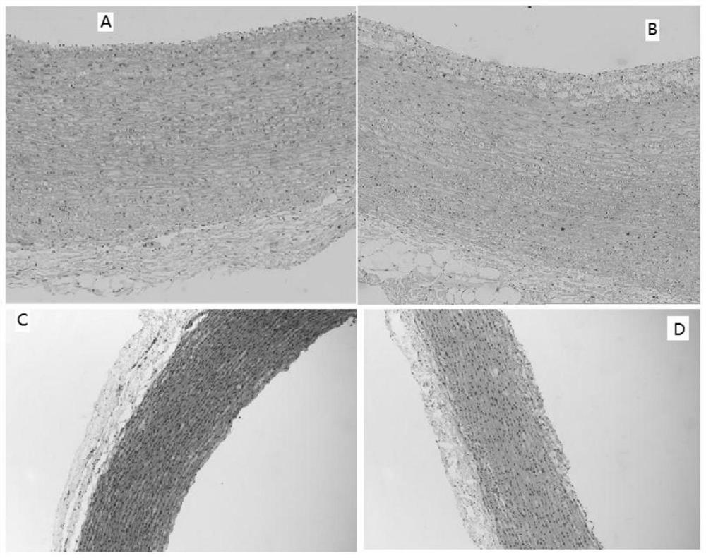 Application and extraction method of caulis spatholobi and caulis spatholobi leguminous similar medicinal materials