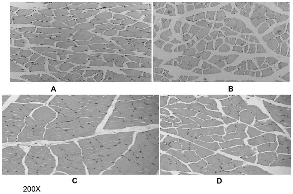 Application and extraction method of caulis spatholobi and caulis spatholobi leguminous similar medicinal materials