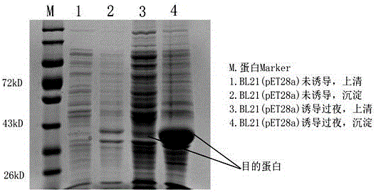 Lactobacillus brevis DM9218 capable of reducing blood uric acid, gene segment and recombinant protein